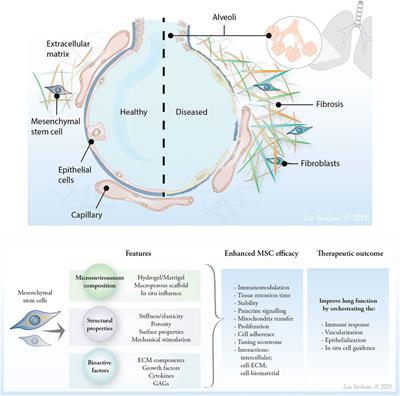 Harnessing the ECM Microenvironment to Ameliorate Mesenchymal Stromal Cell-Based Therapy in <mark class="highlighted">Chronic Lung Diseases</mark>